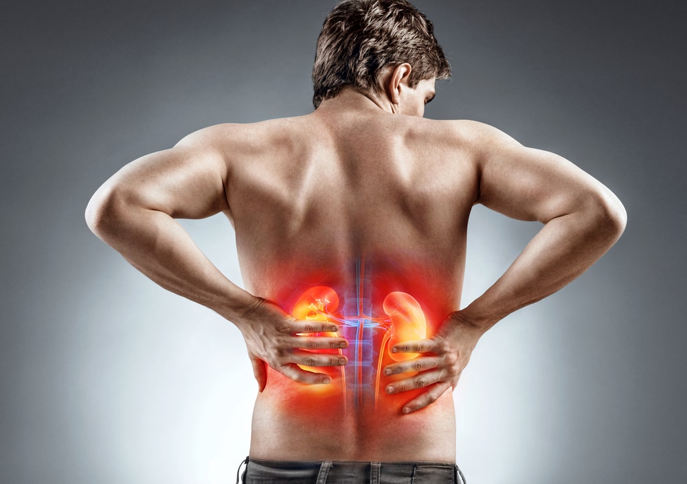 7 Quick Guide To Know what is kidney stone pain like?