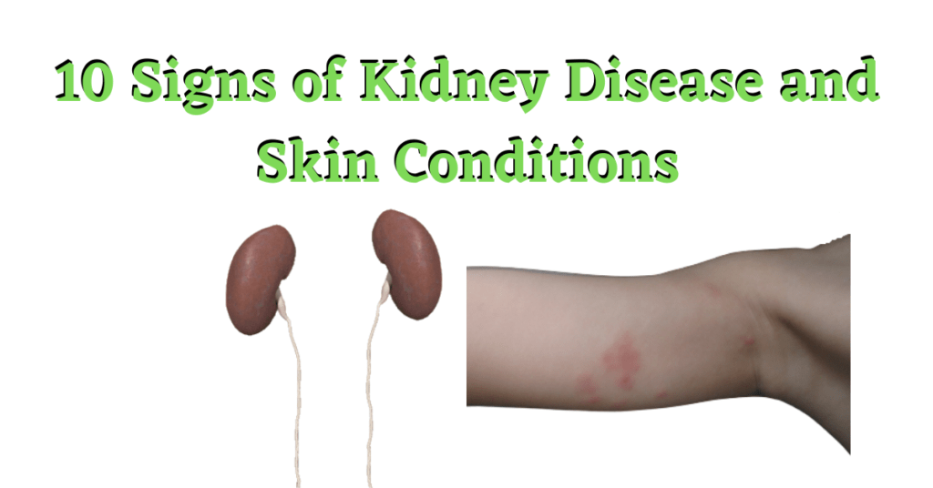 10-signs-of-kidney-disease-and-skin-conditions-turn-to-be-healthy