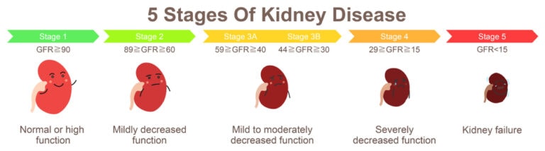 10 Free Tips: How Does Diabetes Cause Kidney Disease? – Turn To Be Healthy